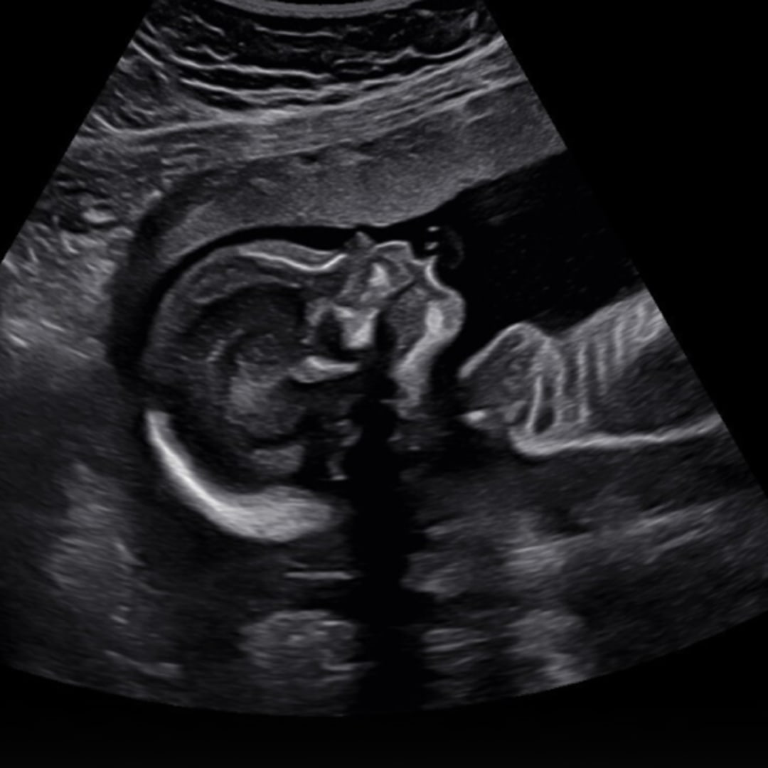 Photo shared by Lucy for their Babylist baby registry.
