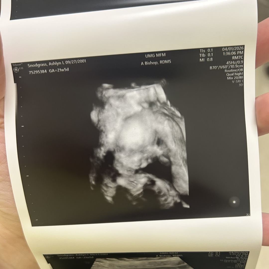 Photo shared by Ashlyn for their Babylist baby registry.