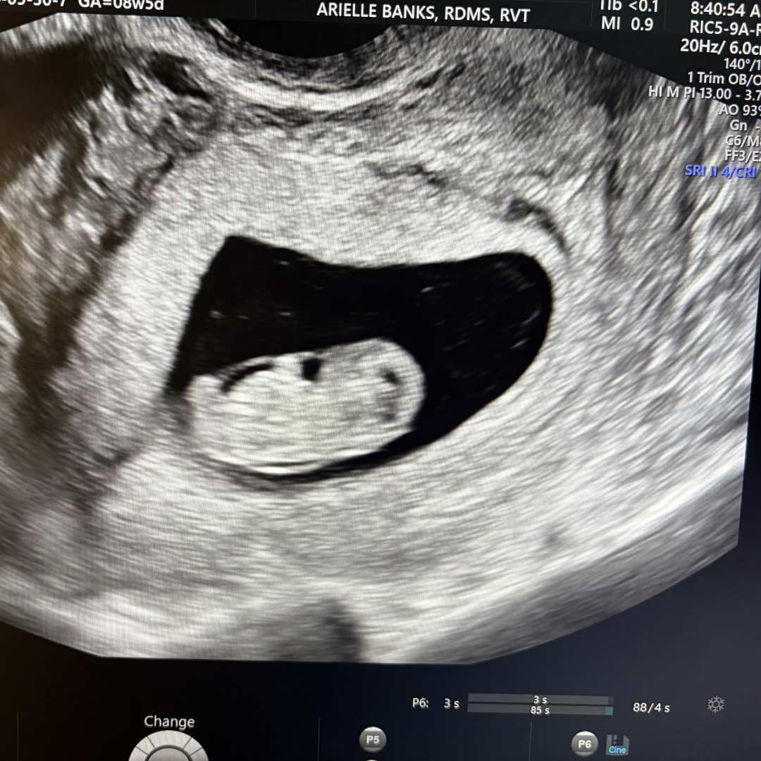 Photo shared by Tracey for their Babylist baby registry.