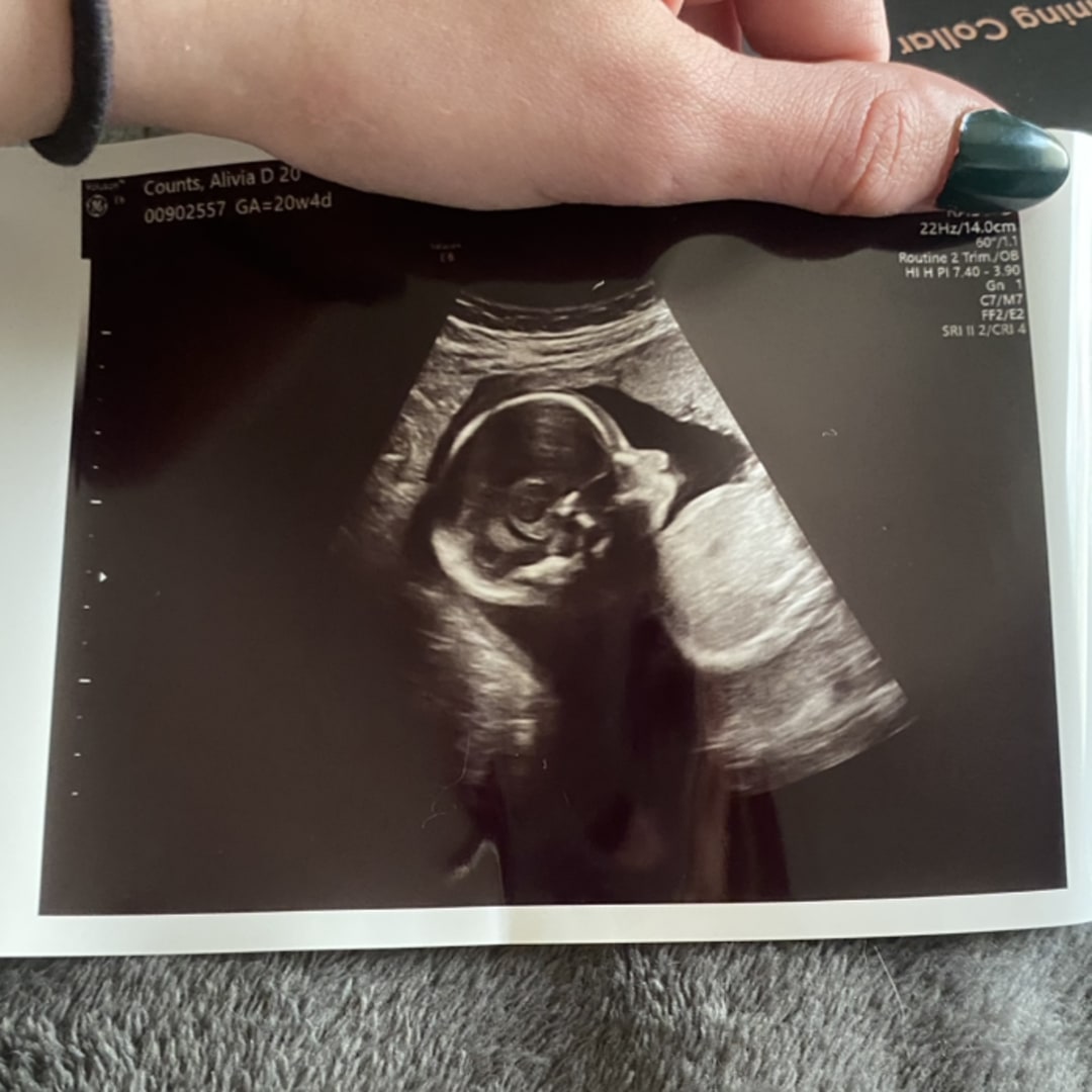 Photo shared by Alivia for their Babylist baby registry.