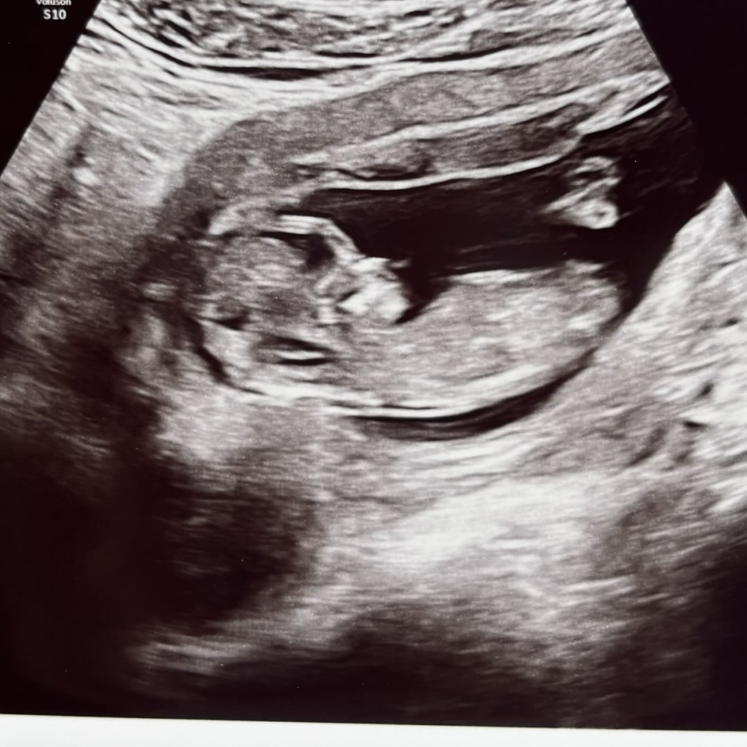Photo shared by Valentina for their Babylist baby registry.