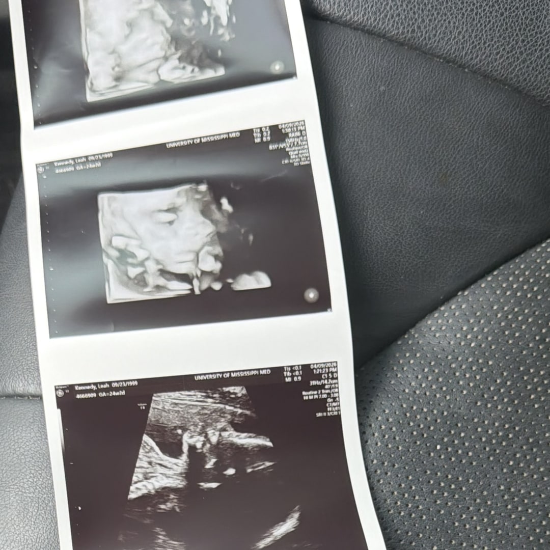 Photo shared by Leah for their Babylist baby registry.