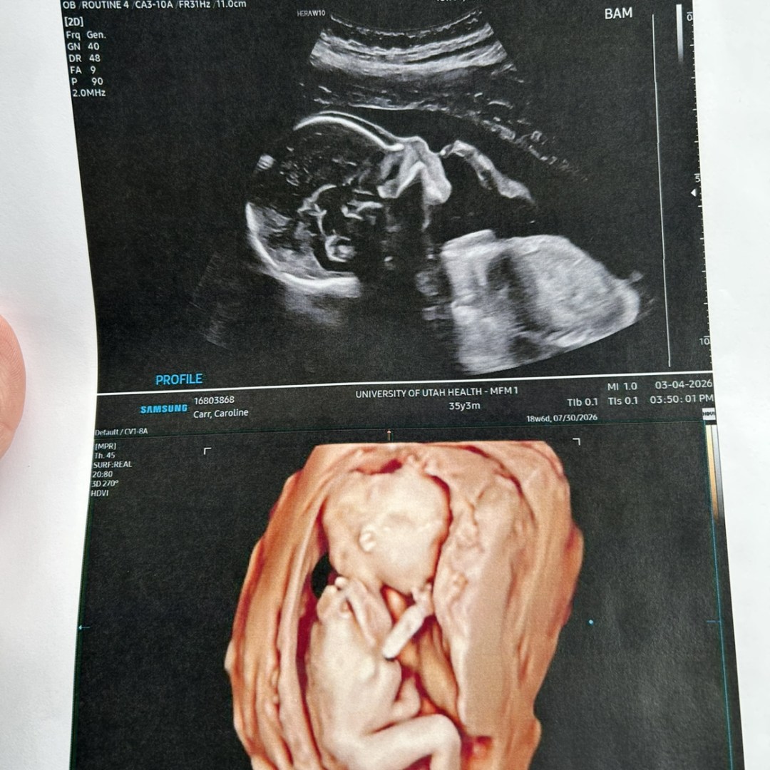 Photo shared by Caroline for their Babylist baby registry.