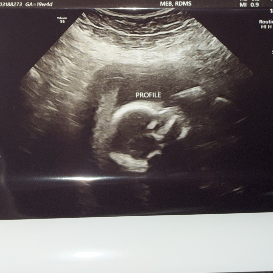 Photo shared by Alexis for their Babylist baby registry.