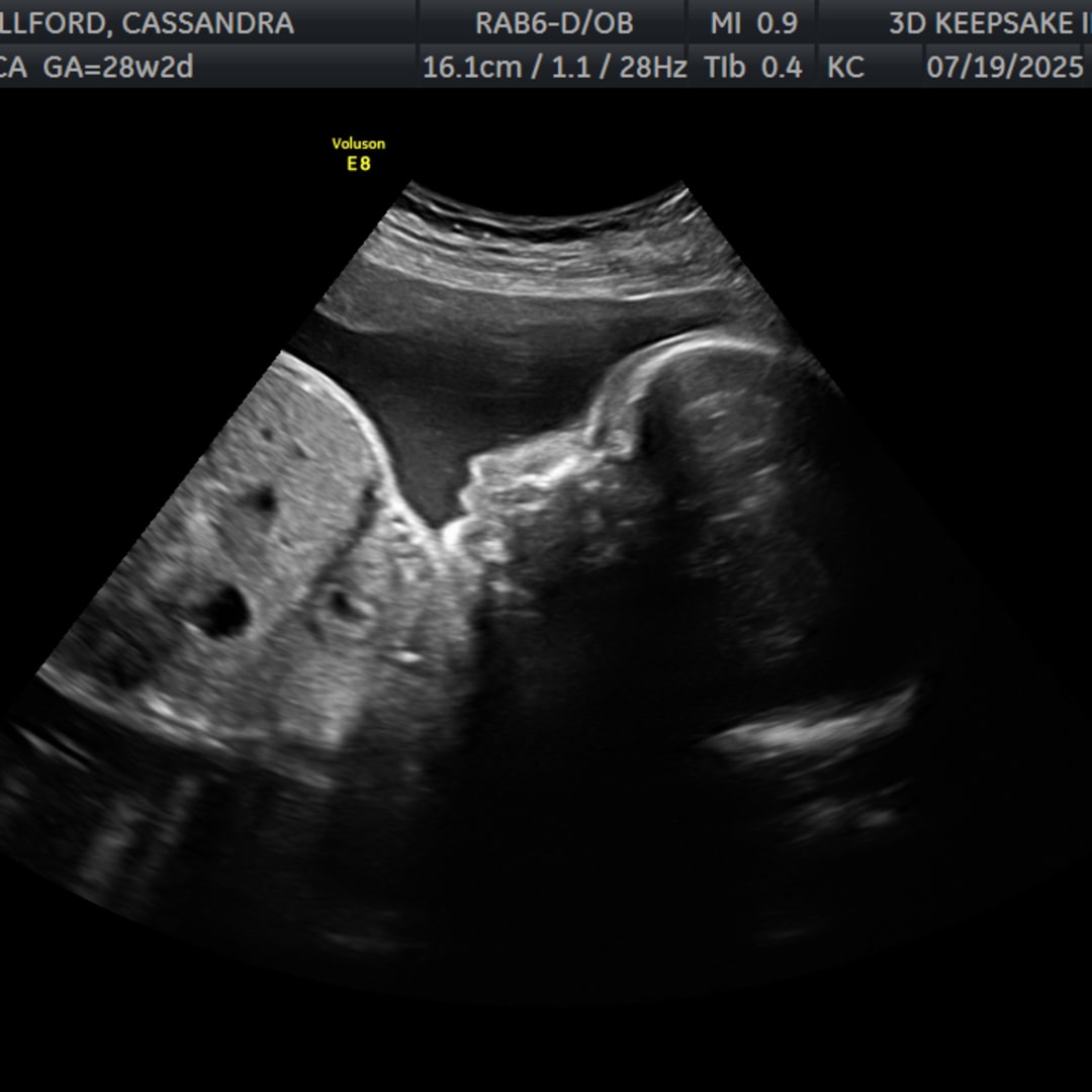 Photo shared by Cassandra for their Babylist baby registry.