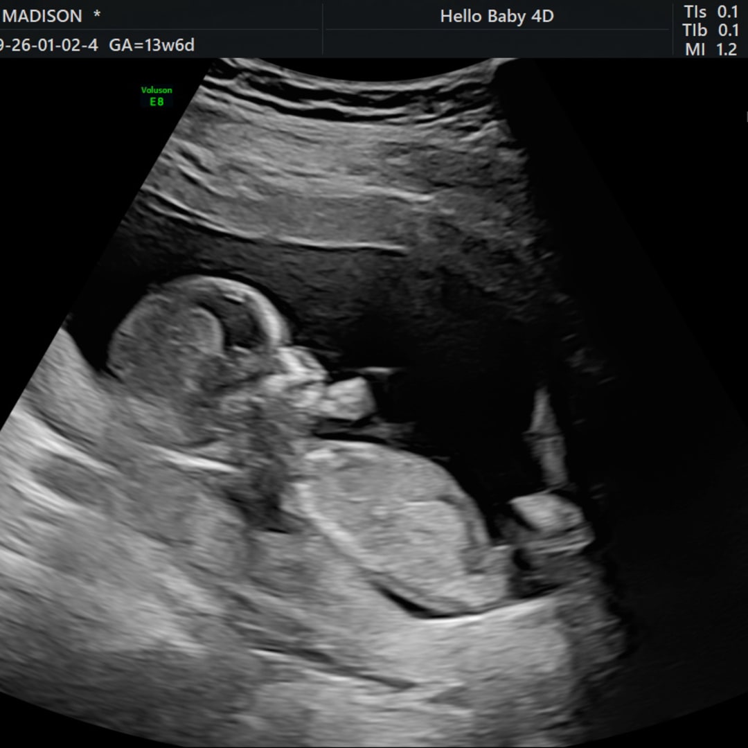 Photo shared by Madi for their Babylist baby registry.