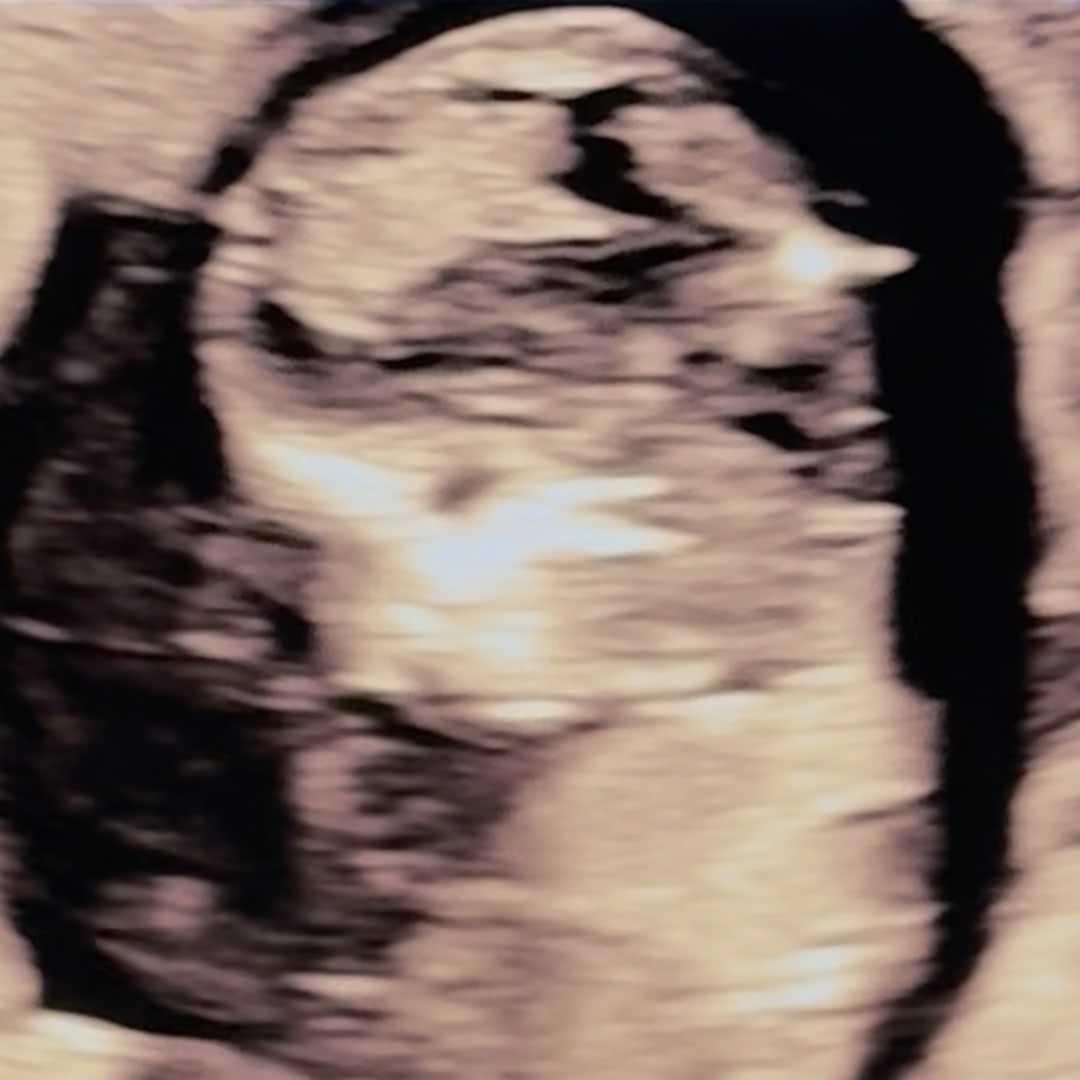 Photo shared by Lara for their Babylist baby registry.