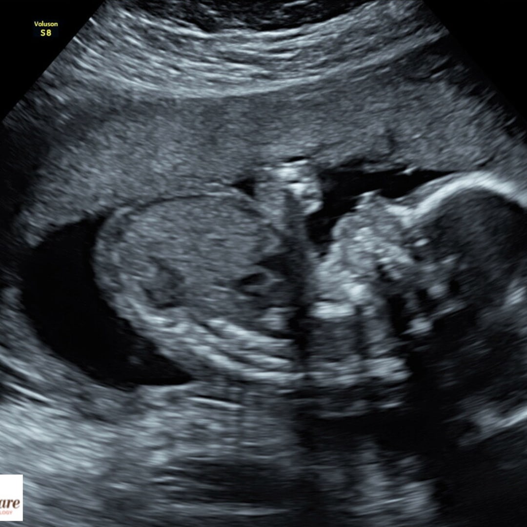 Photo shared by Ariel for their Babylist baby registry.