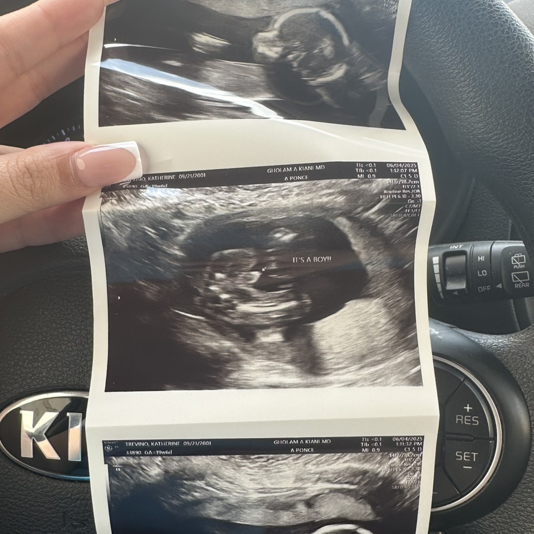 Photo shared by Katherine for their Babylist baby registry.