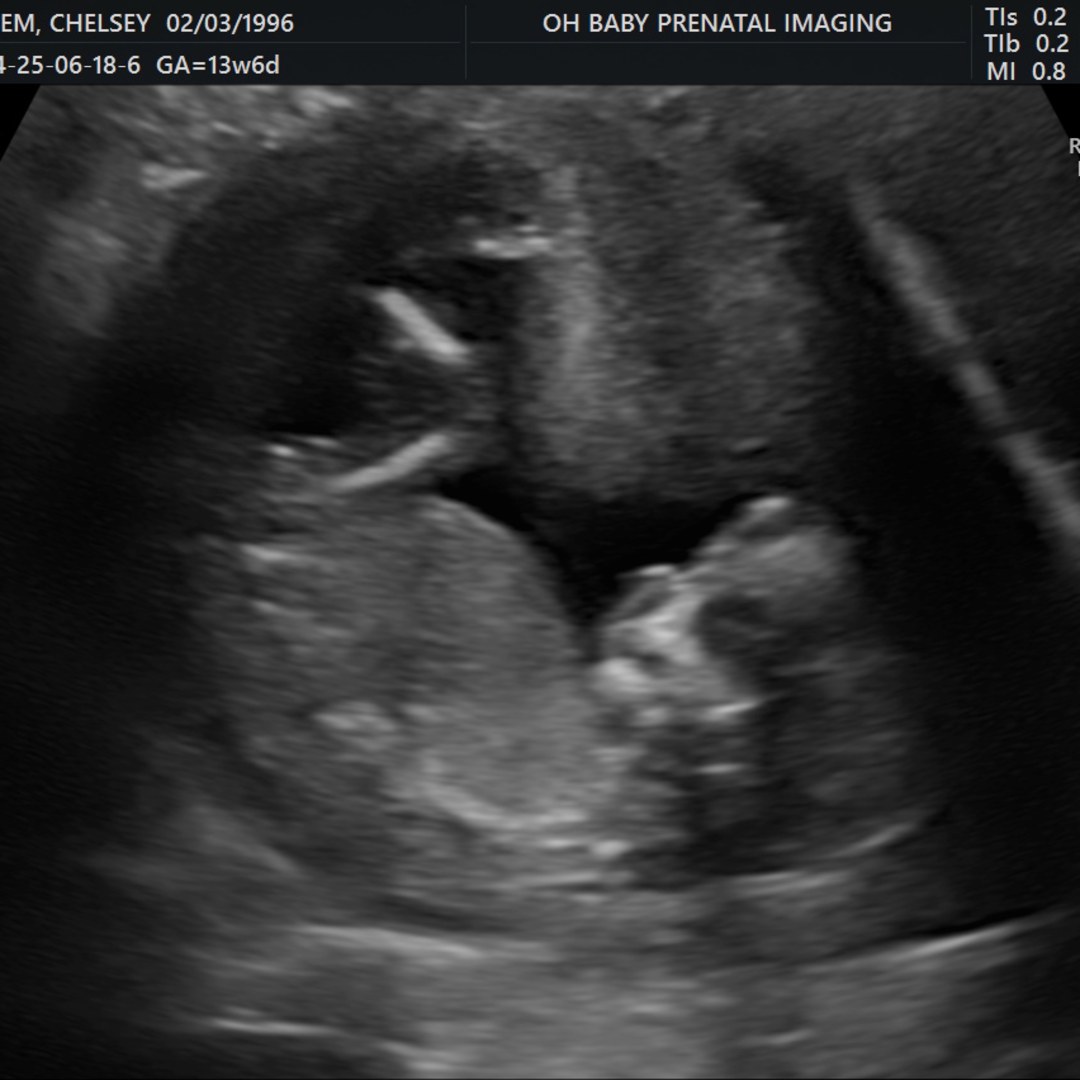 Photo shared by Chelsey for their Babylist baby registry.