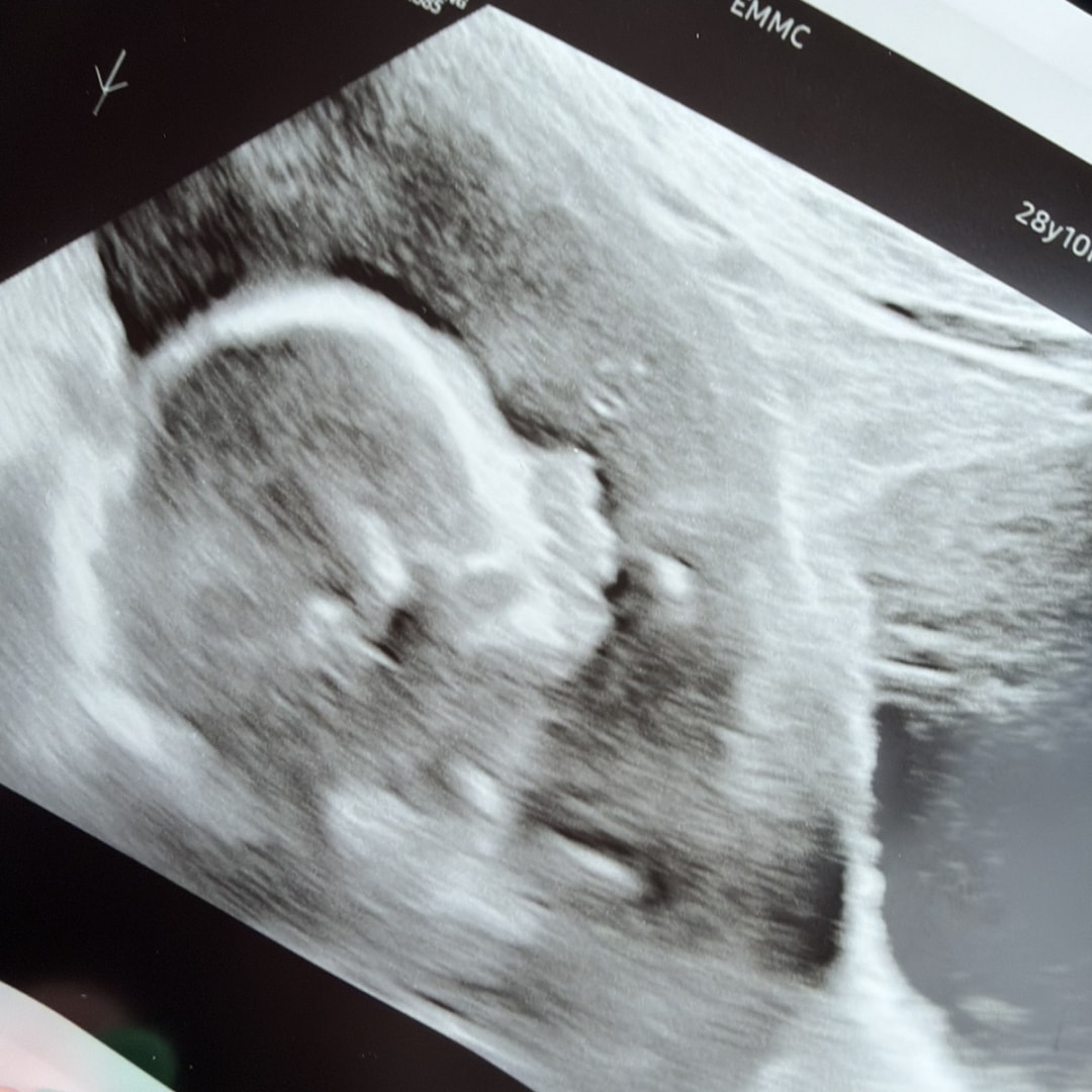 Photo shared by Grace for their Babylist baby registry.
