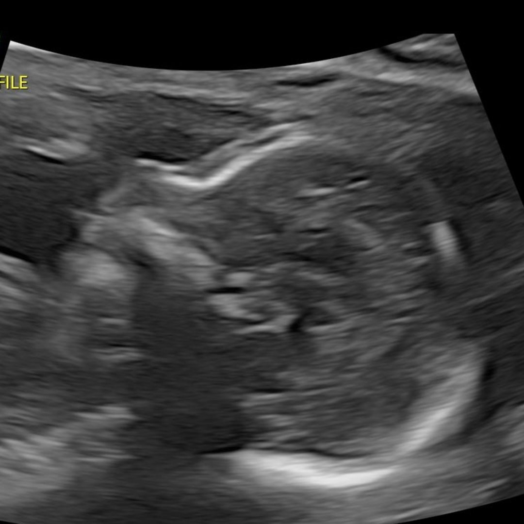 Photo shared by Katie for their Babylist baby registry.