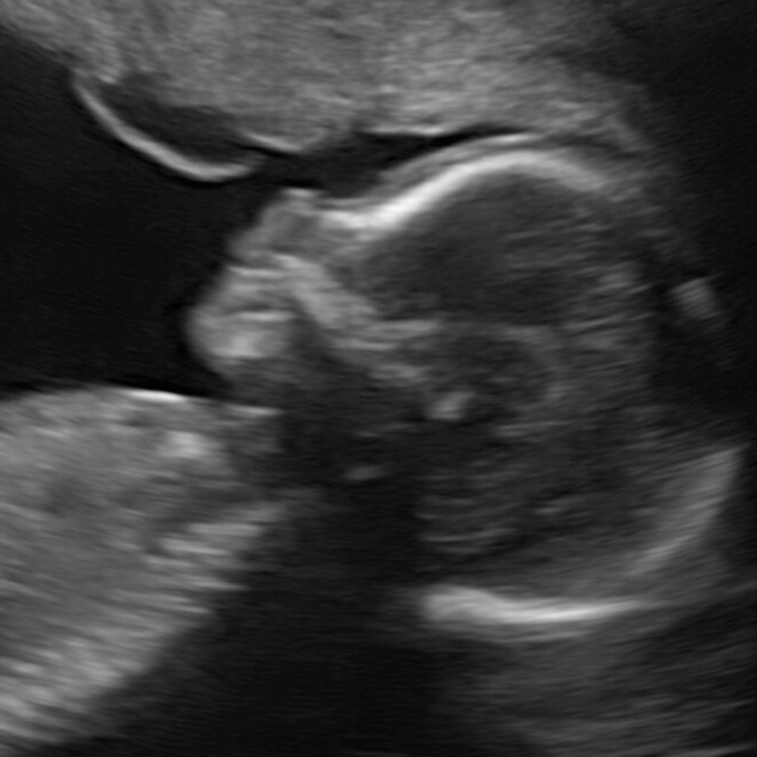 Photo shared by Katie for their Babylist baby registry.