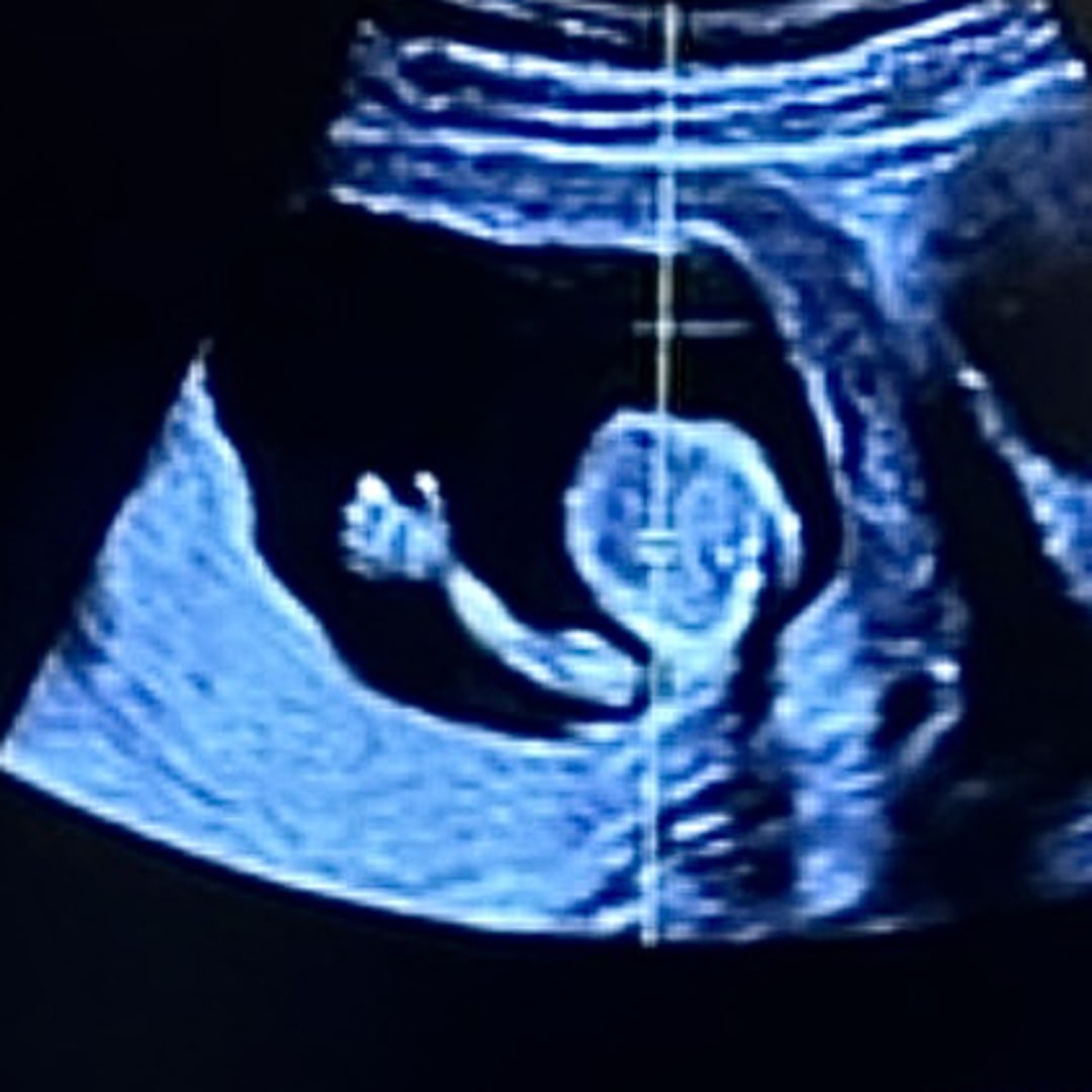 Photo shared by Karoline for their Babylist baby registry.