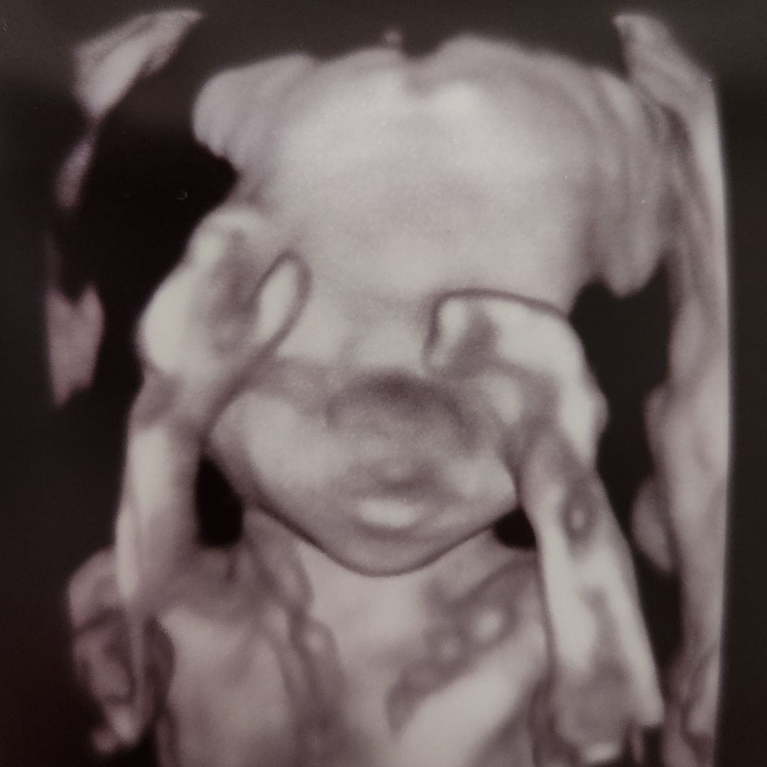 Photo shared by Brenda for their Babylist baby registry.