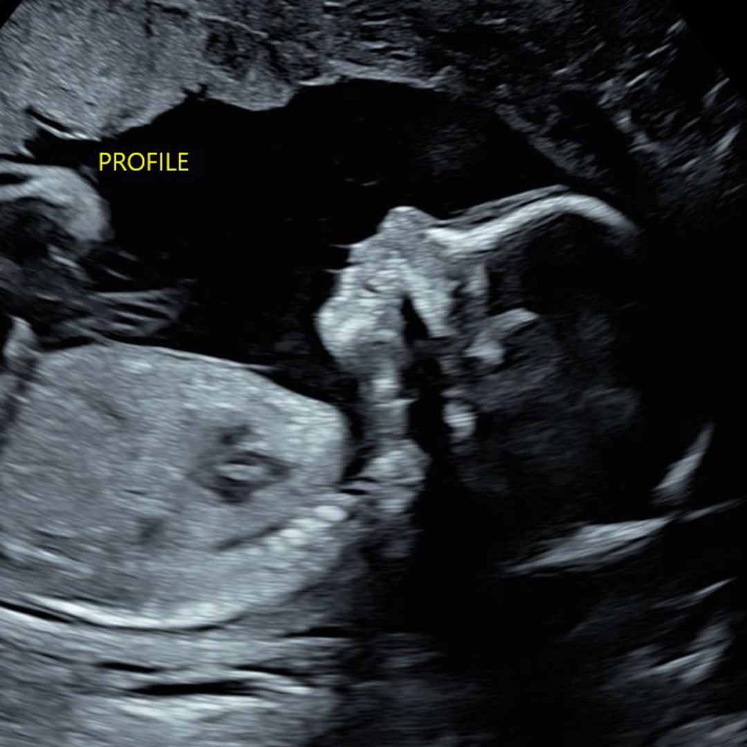 Photo shared by Sydney for their Babylist baby registry.