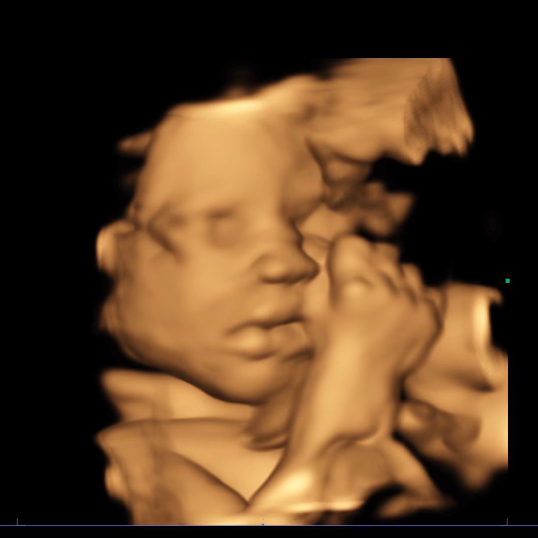 Photo shared by Cassidy for their Babylist baby registry.