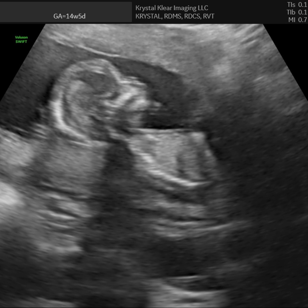 Photo shared by Andrea for their Babylist baby registry.