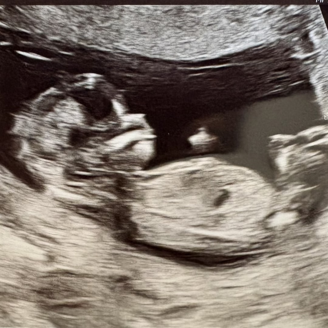 Photo shared by Elly for their Babylist baby registry.