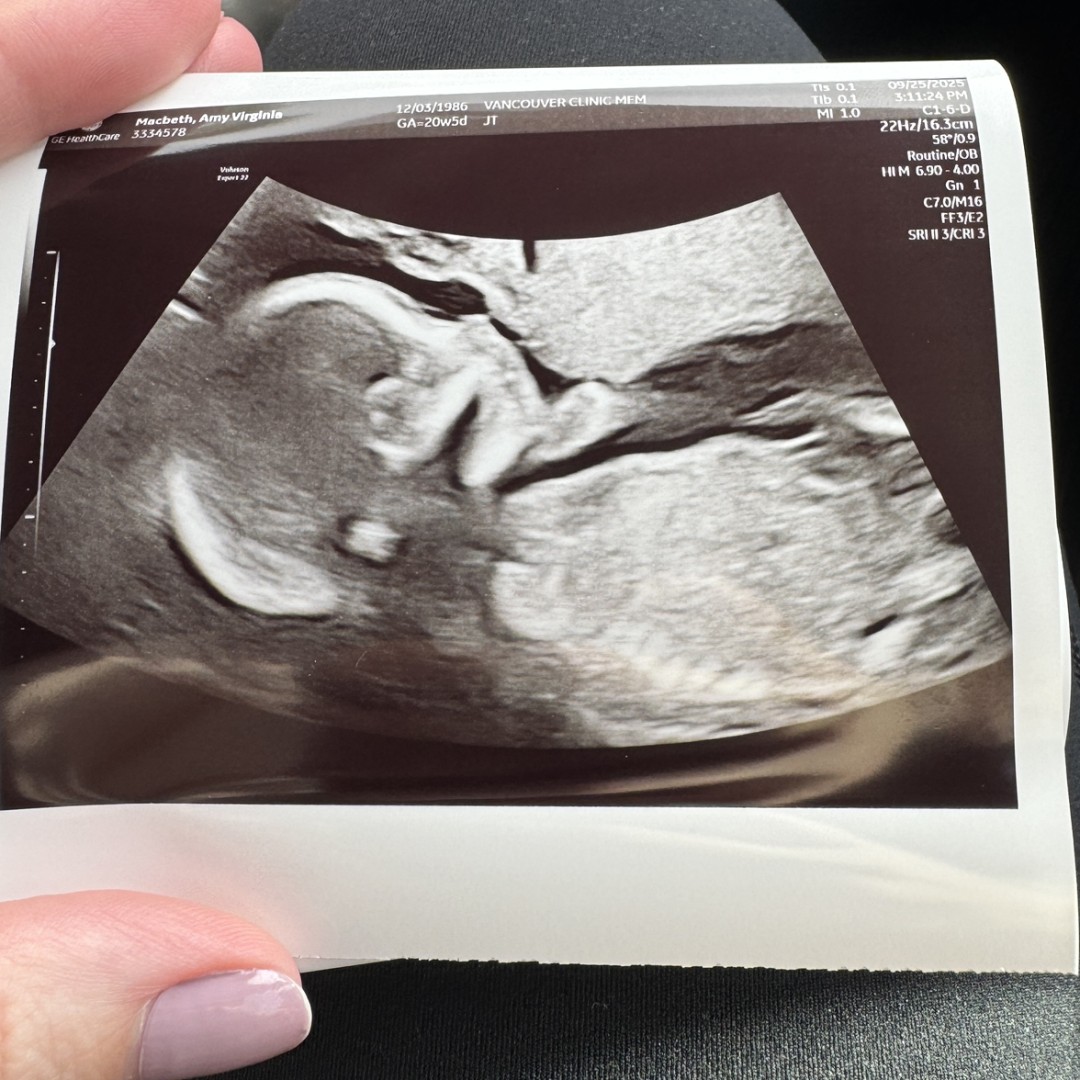 Photo shared by Amy for their Babylist baby registry.