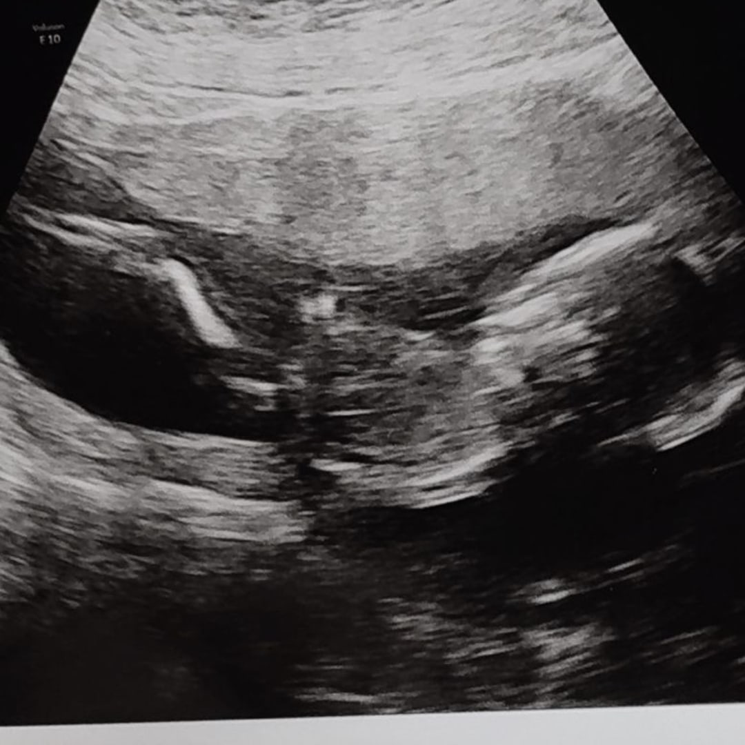 Photo shared by Drue for their Babylist baby registry.