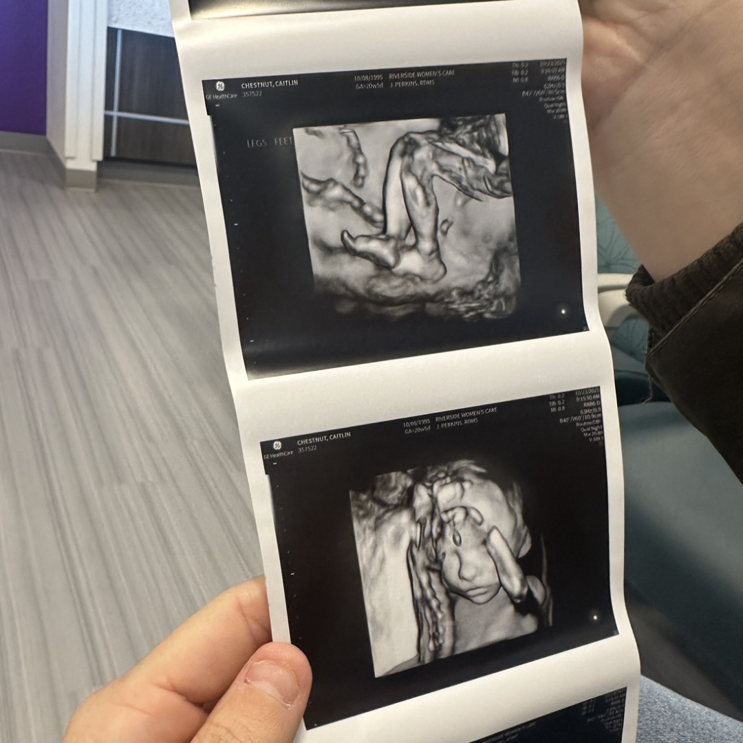 Photo shared by Caitlin for their Babylist baby registry.