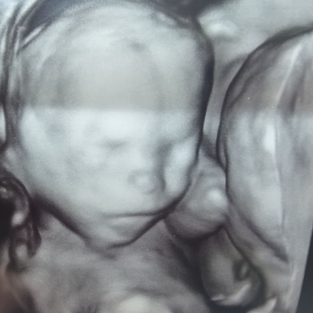 Photo shared by Amber for their Babylist baby registry.