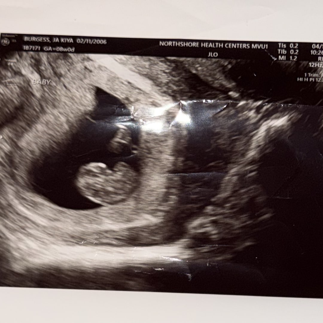 Photo shared by Jakiya for their Babylist baby registry.