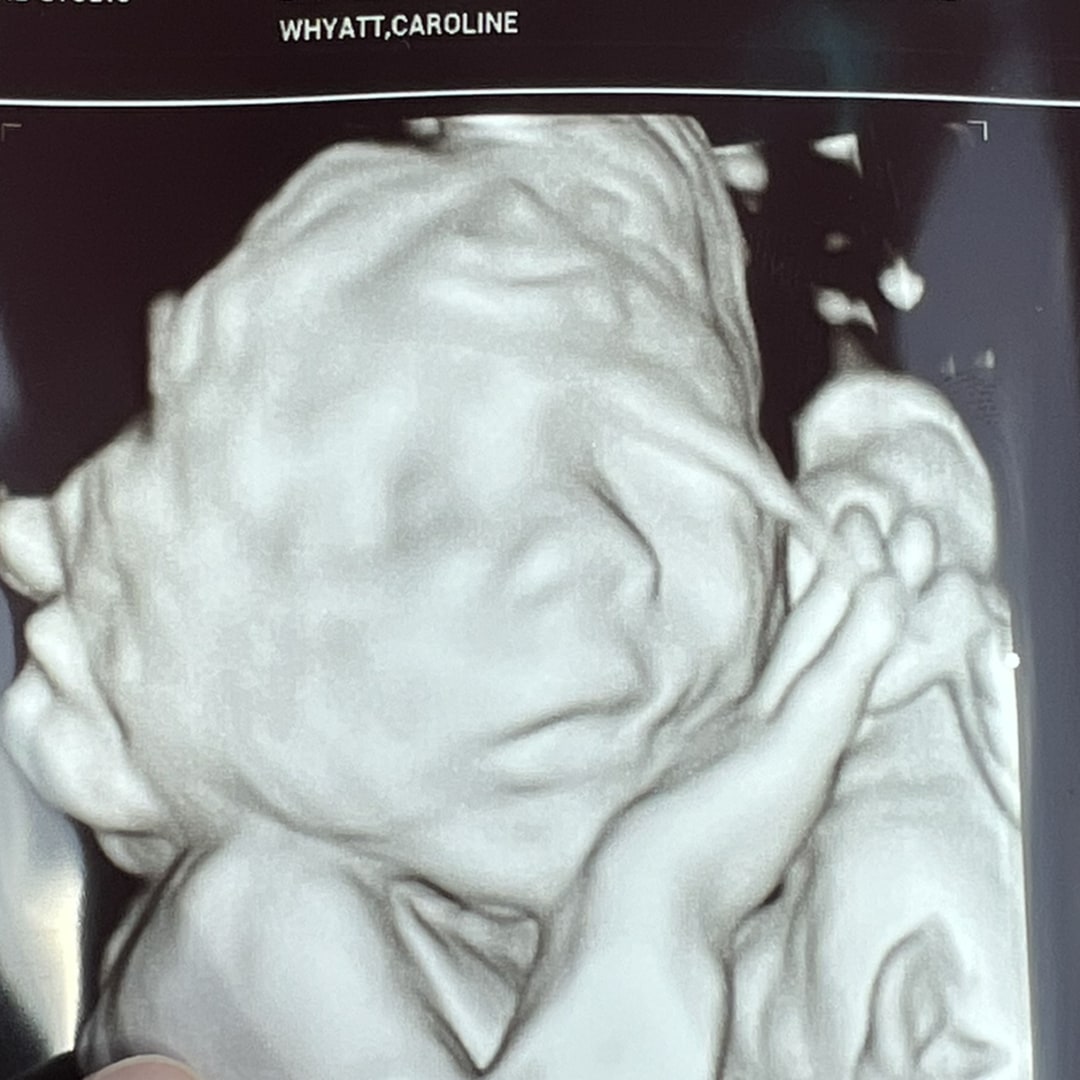 Photo shared by Caroline for their Babylist baby registry.