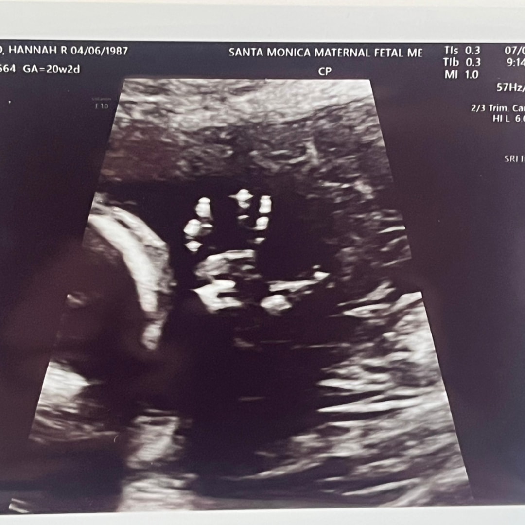 Photo shared by Hannah for their Babylist baby registry.