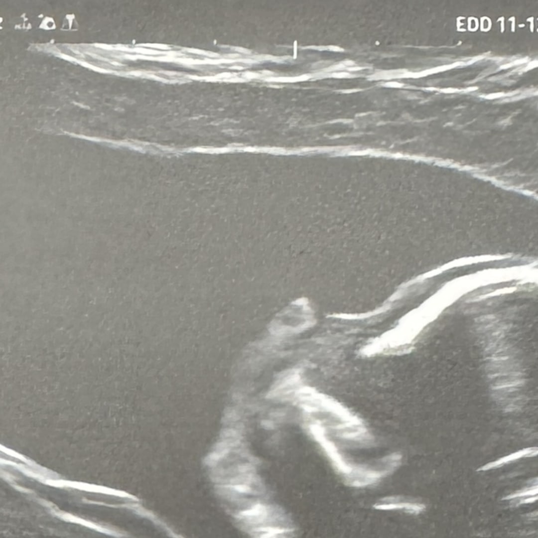 Photo shared by Yadira for their Babylist baby registry.