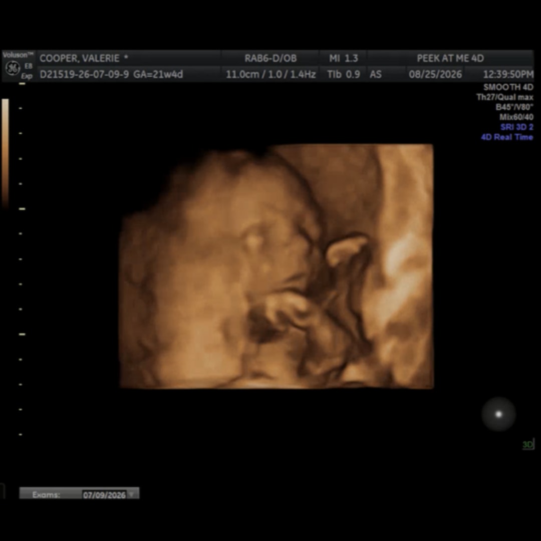 Photo shared by Valerie for their Babylist baby registry.