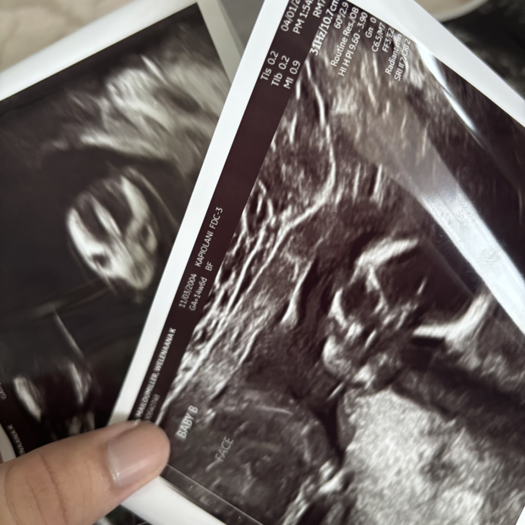 Photo shared by Aden for their Babylist baby registry.