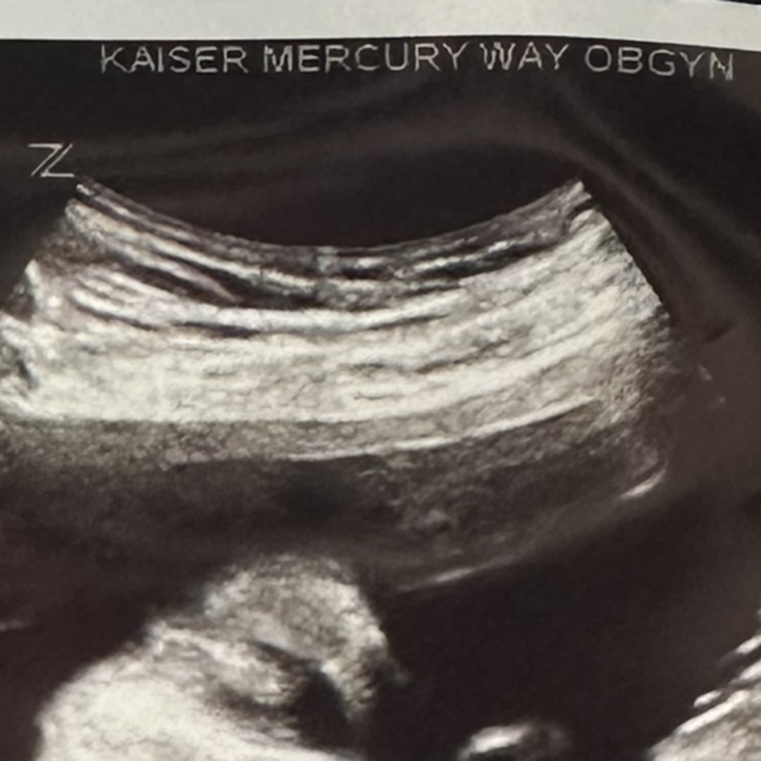 Photo shared by Jennifer for their Babylist baby registry.