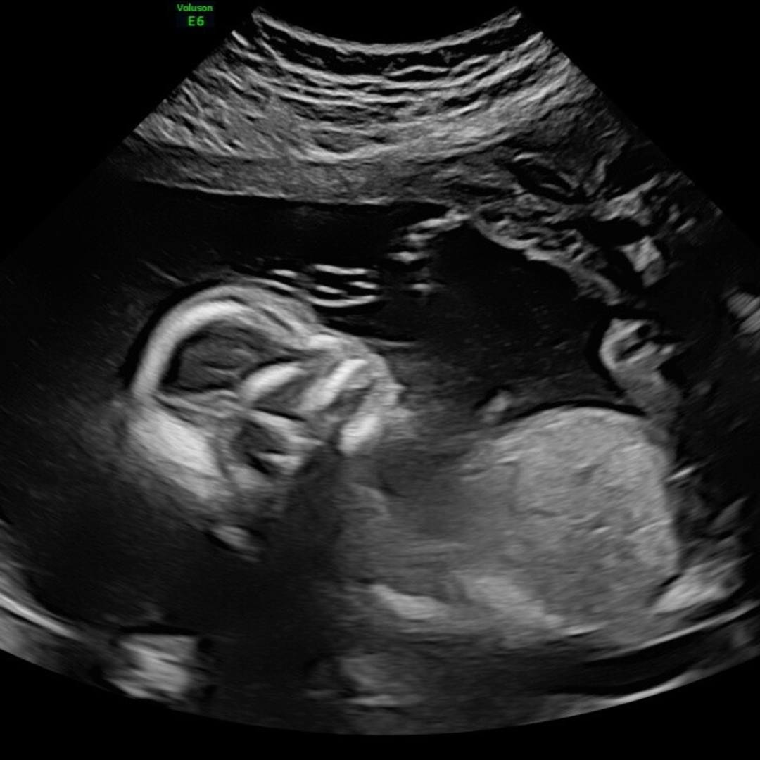 Photo shared by M Florencia for their Babylist baby registry.