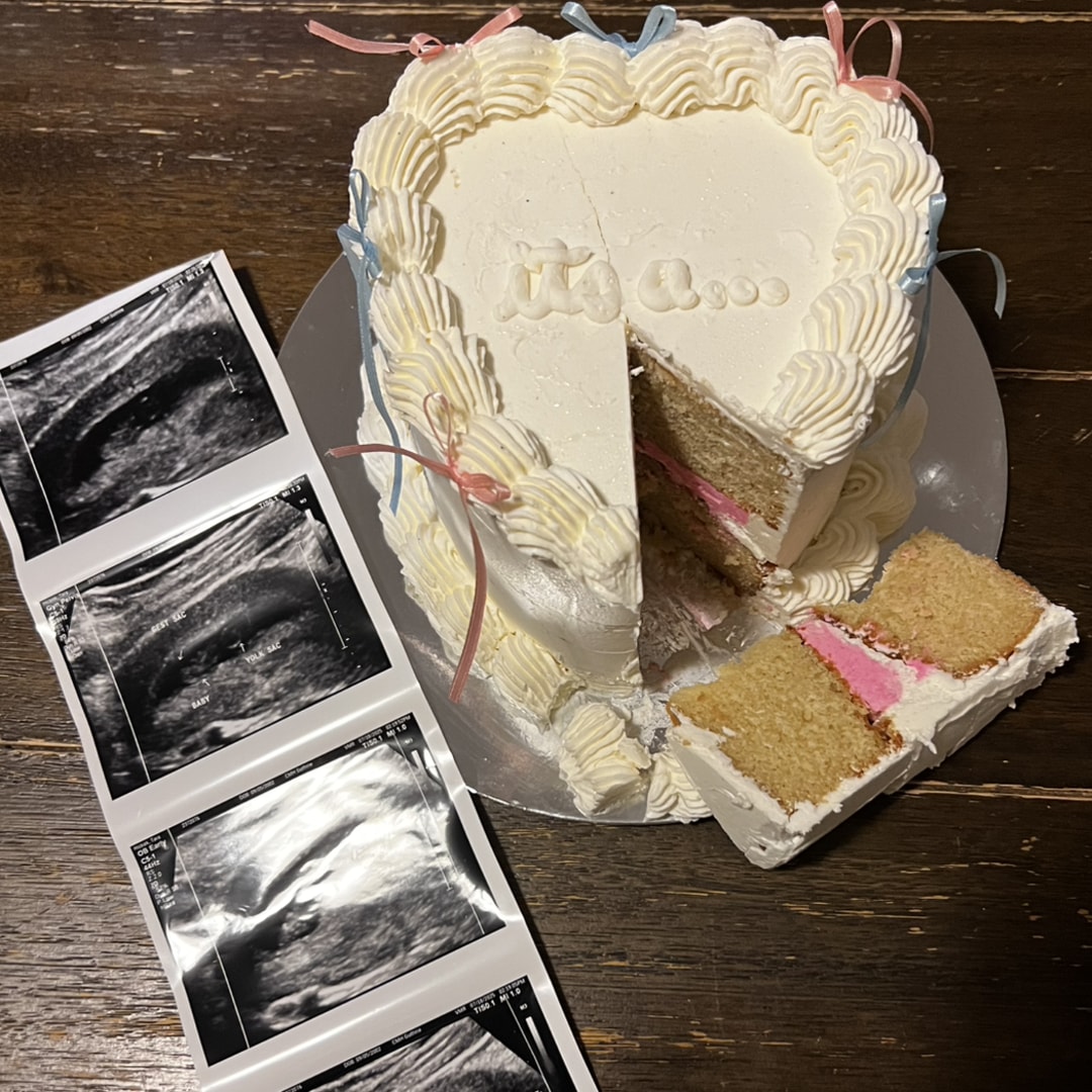 Photo shared by Tara for their Babylist baby registry.