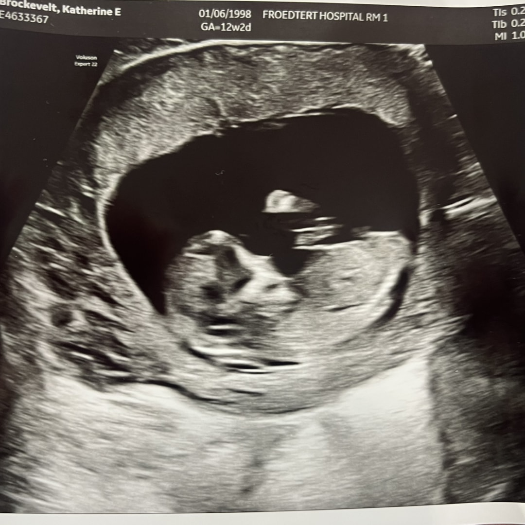 Photo shared by Kate for their Babylist baby registry.