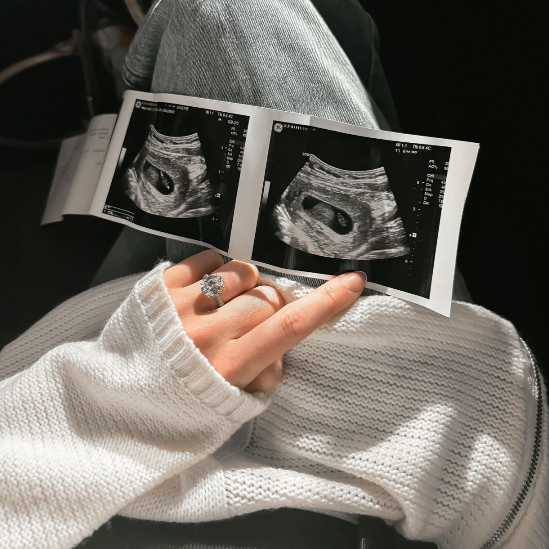 Photo shared by Christie for their Babylist baby registry.