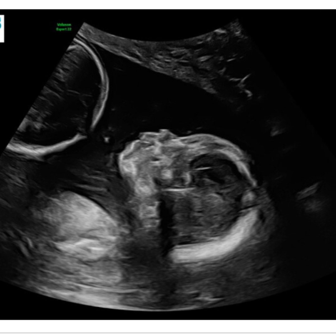 Photo shared by Jaelene for their Babylist baby registry.
