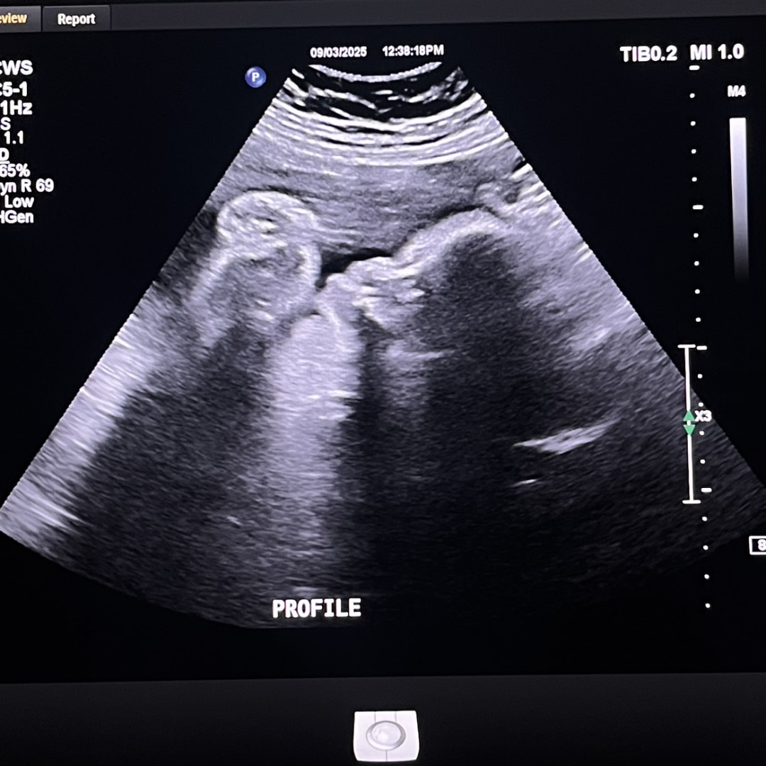 Photo shared by Fay for their Babylist baby registry.