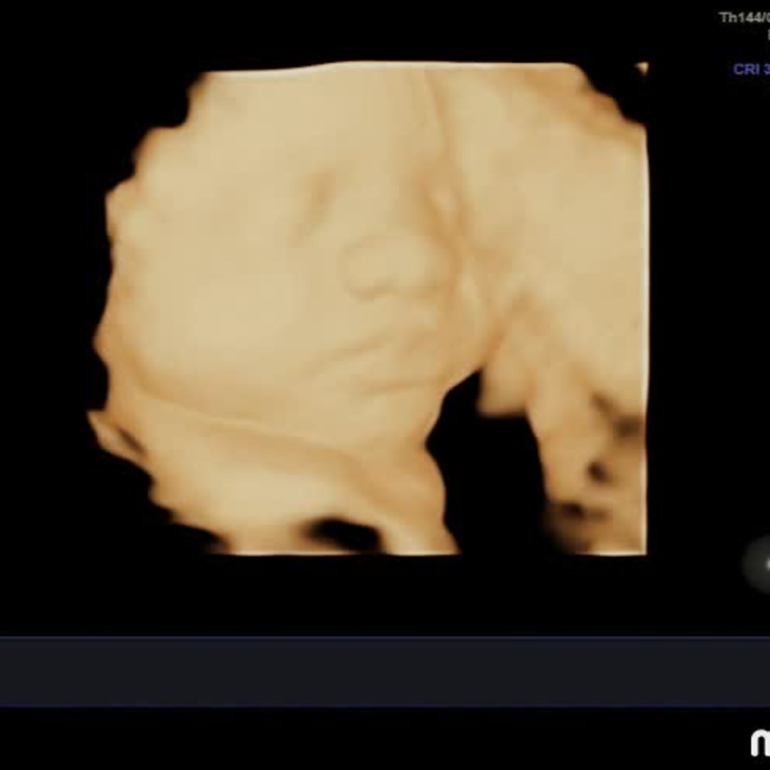 Photo shared by Brittany for their Babylist baby registry.