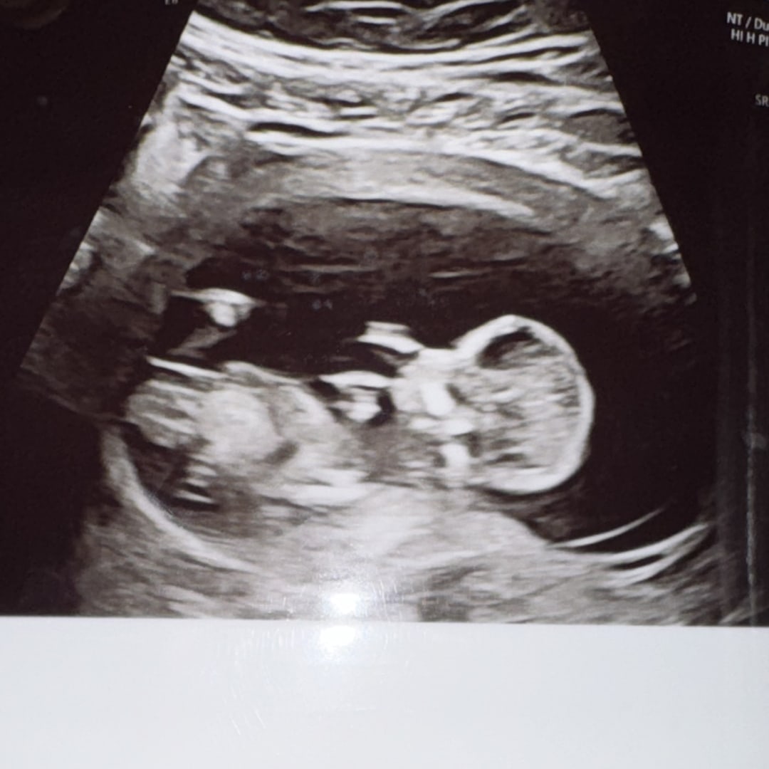Photo shared by Kelsi for their Babylist baby registry.