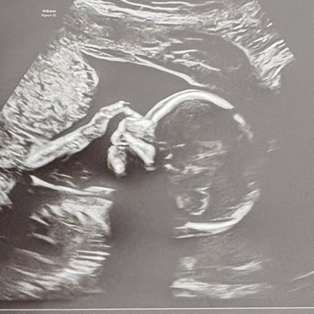 Photo shared by Adeline for their Babylist baby registry.