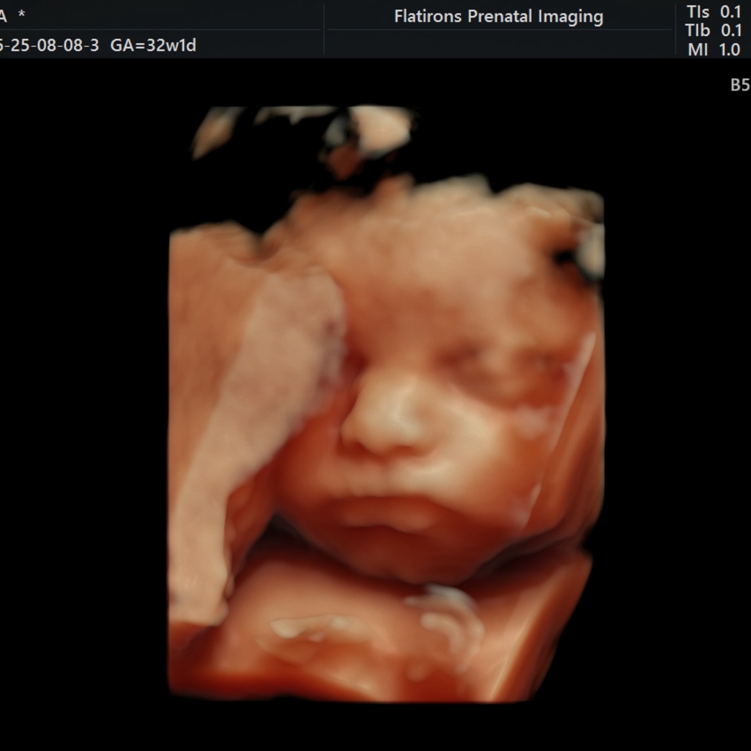 Photo shared by Alondra for their Babylist baby registry.