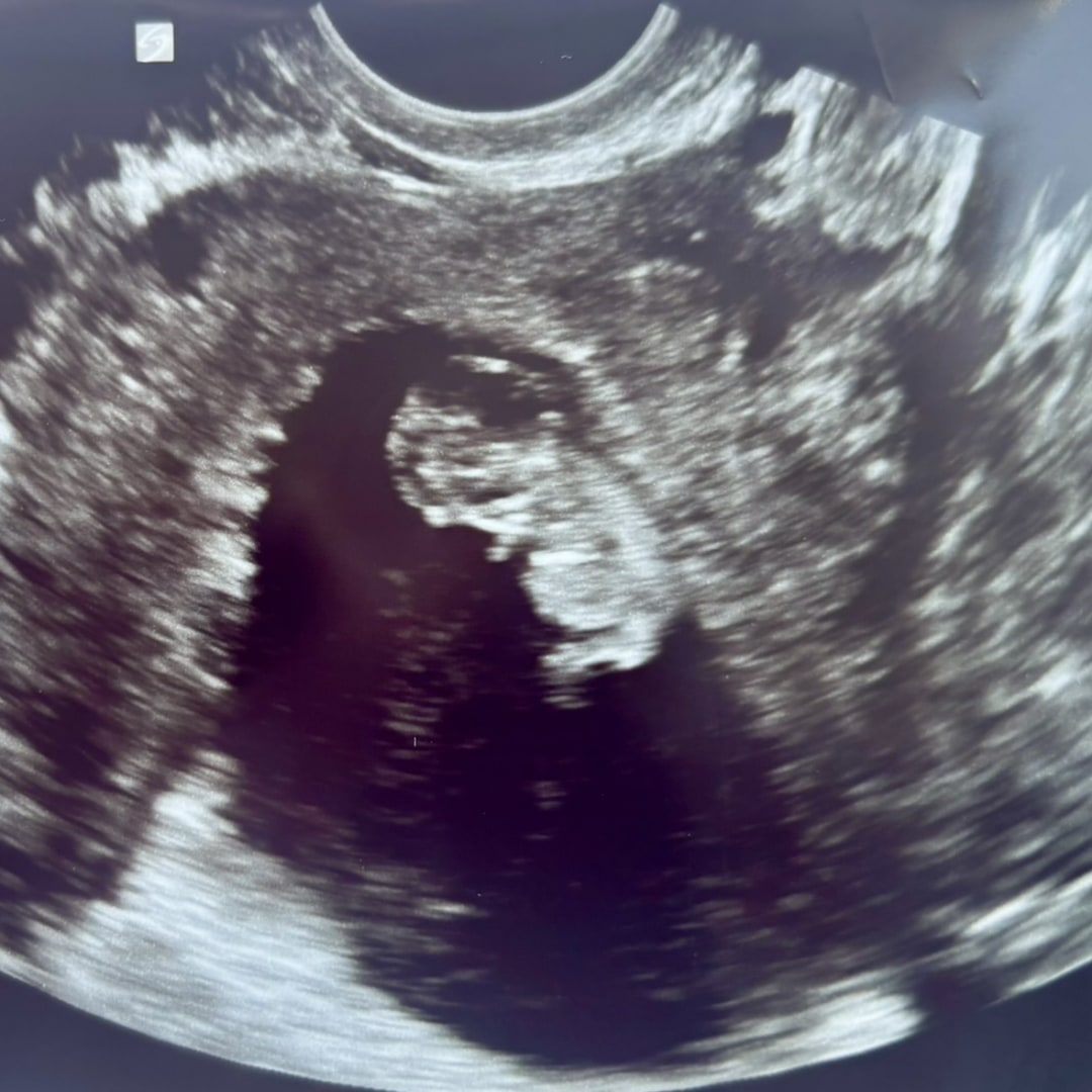 Photo shared by Alexia for their Babylist baby registry.