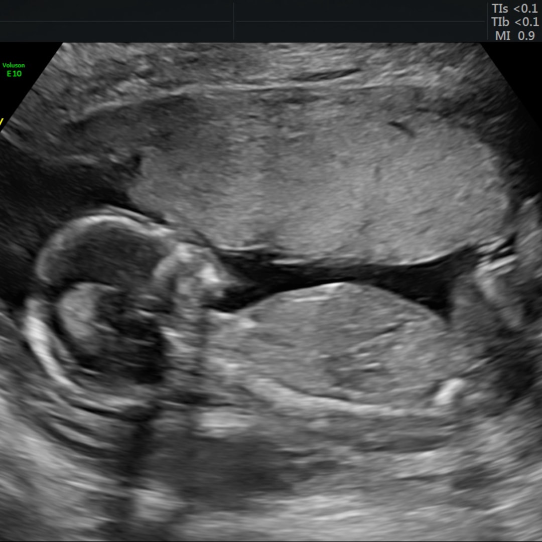 Photo shared by Casey for their Babylist baby registry.