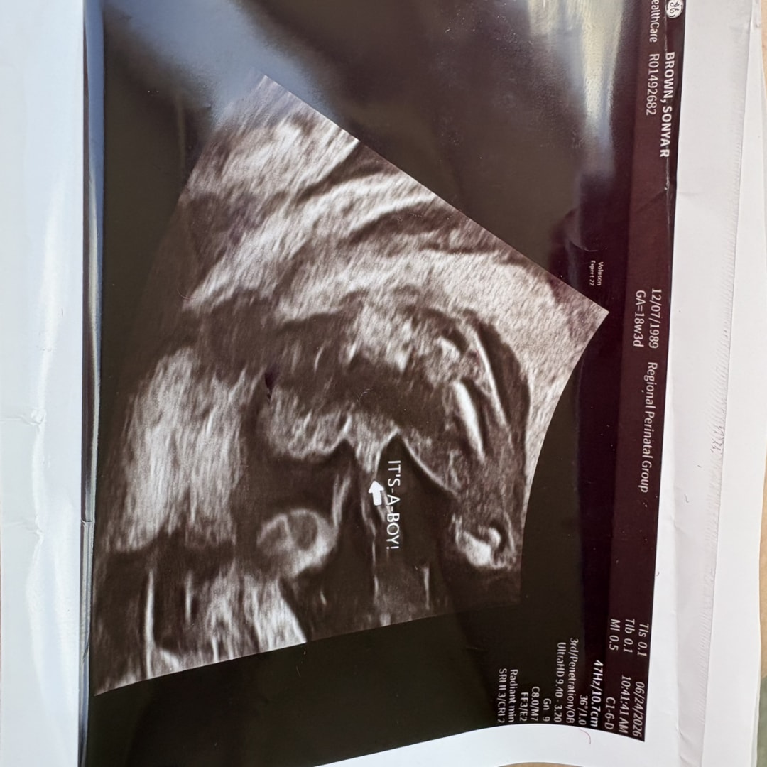 Photo shared by Sonya for their Babylist baby registry.