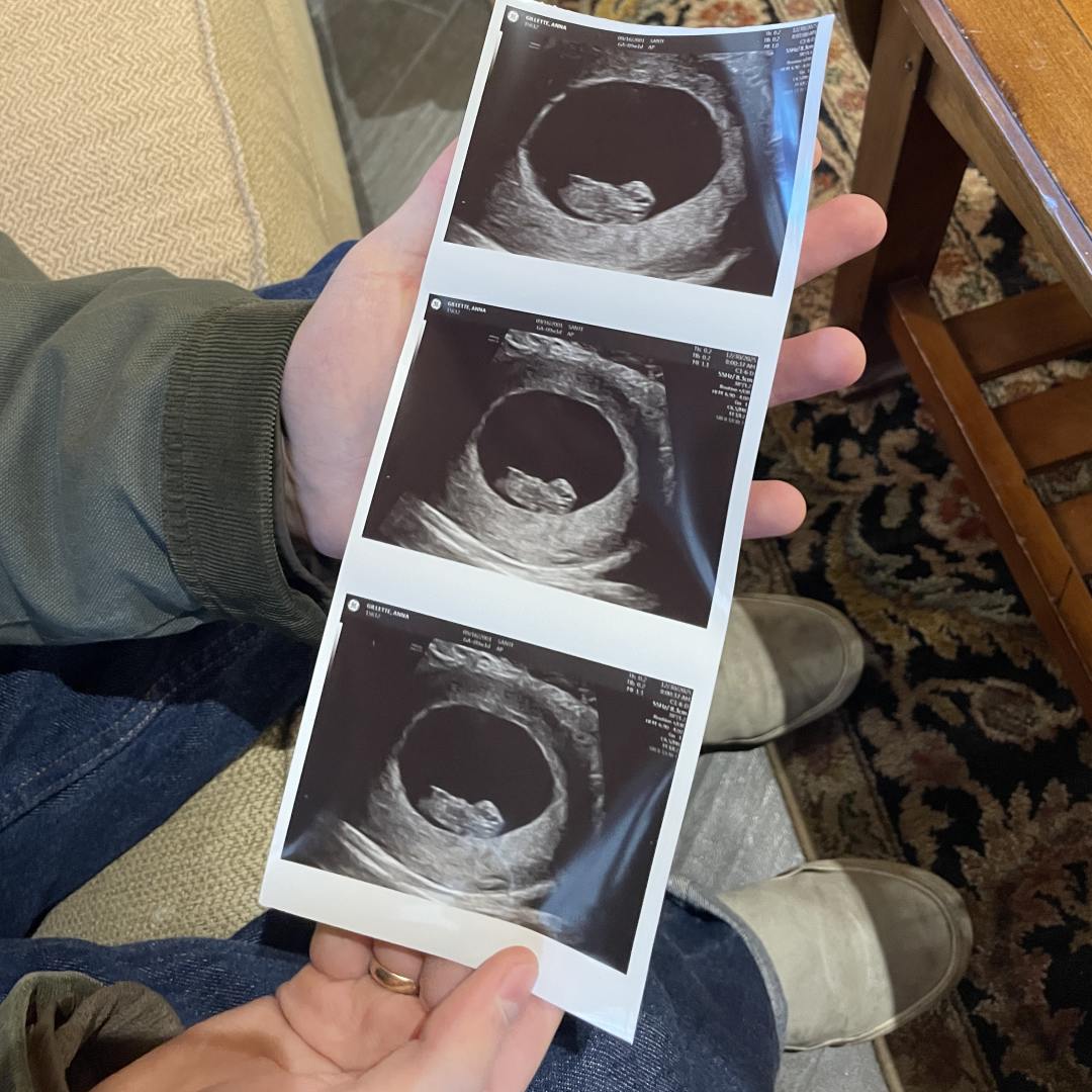 Photo shared by Anna for their Babylist baby registry.