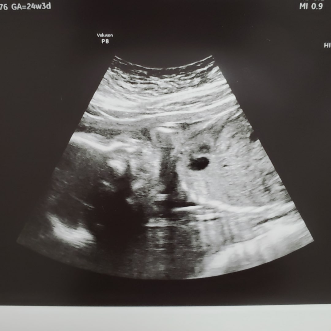 Photo shared by Kat for their Babylist baby registry.