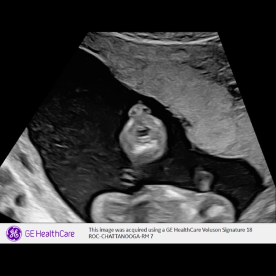 Photo shared by Lindsey for their Babylist baby registry.